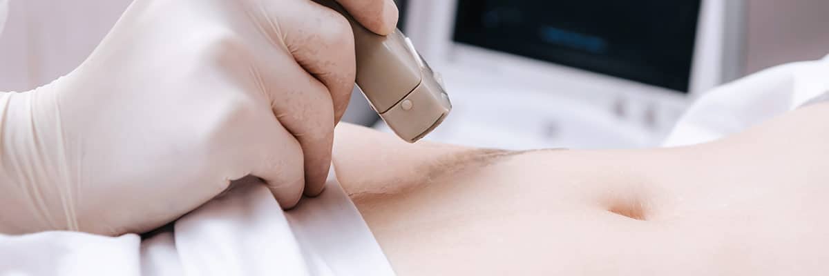 Obstetric Ultrasound